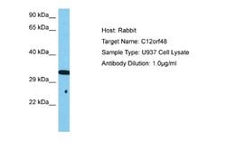 PARPBP Rabbit anti-Human, Polyclonal, Novus Biologicals 0.1 mL | Buy Online | Novus Biologicals | Fisher Scientific